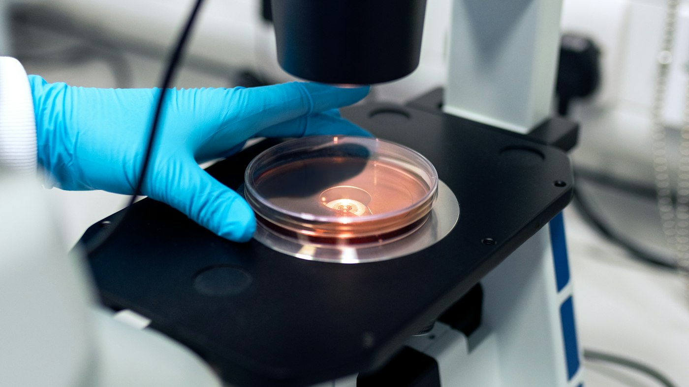 Gloved hands placing a petri dish under a laboratory microscope for cell-culture work