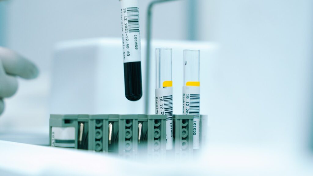 Gloved hand holding a test tube of liquid in a laboratory