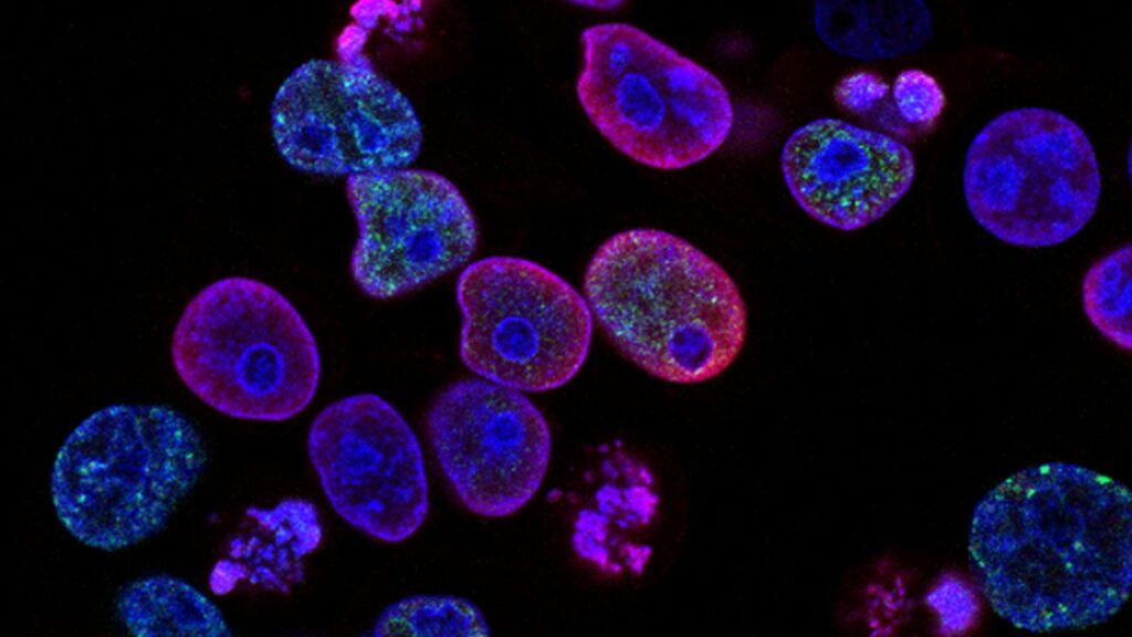 Stained cells viewed under a microscope