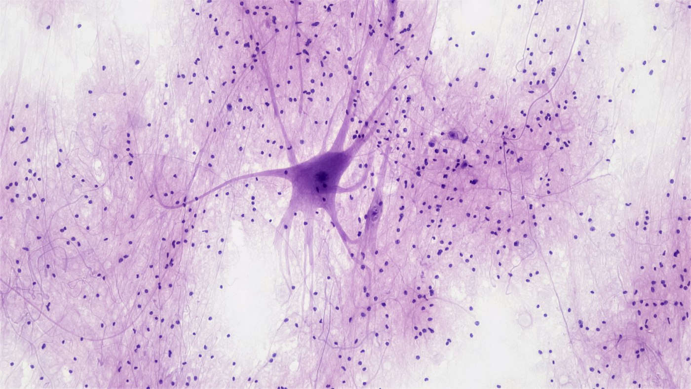 Light micrograph of a stained spinal cord motor neuron in nervous tissue