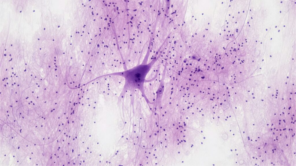 Nootropic Peptides: What the Research Actually Shows 1 Stained micrograph of a spinal cord motor neuron