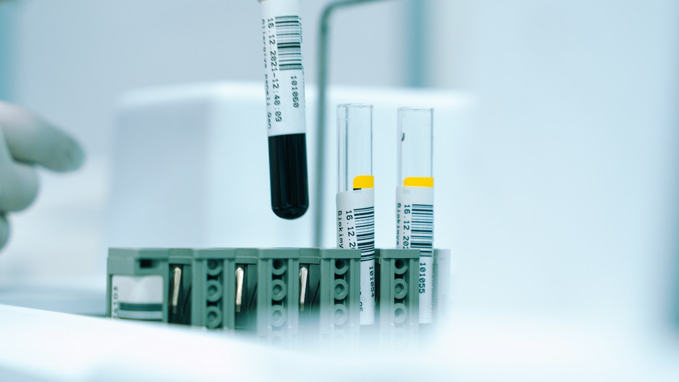 Gloved hand holding a test tube of liquid in a laboratory