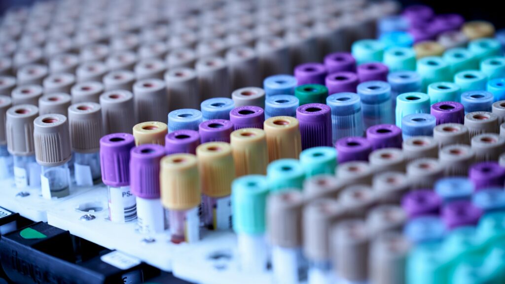 Retatrutide Phase 3 Results: What the TRIUMPH Trials Found 1 Rows of blood collection tubes with coloured caps in a laboratory rack