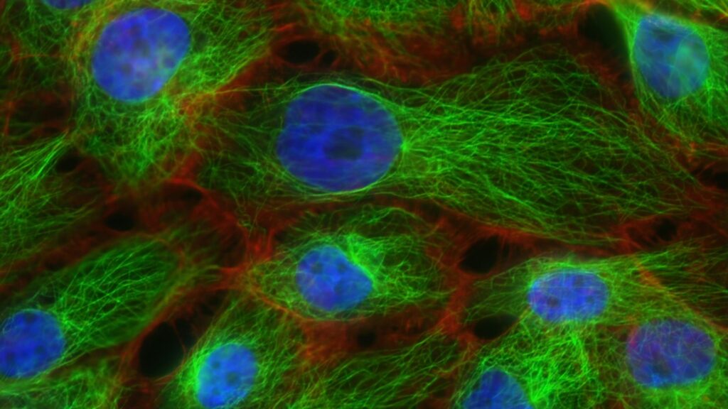 Fluorescence micrograph of cultured human cells showing stress fibres and microtubules