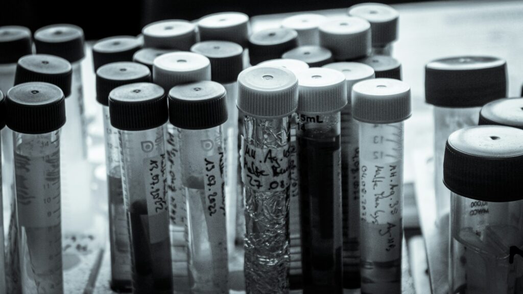 Black-and-white photo of capped glass test tubes standing in a laboratory rack